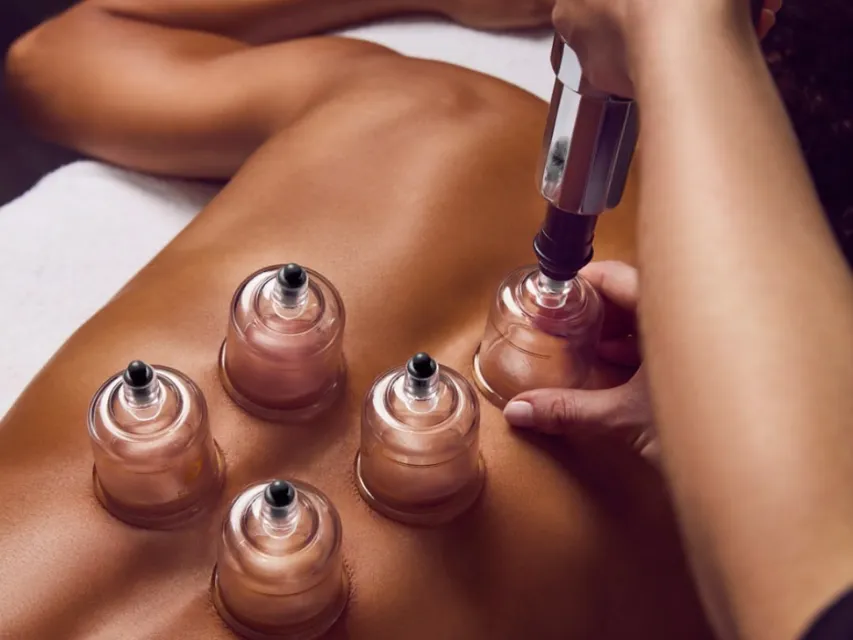 Ventosas aplicadas nas costas durante a massagem